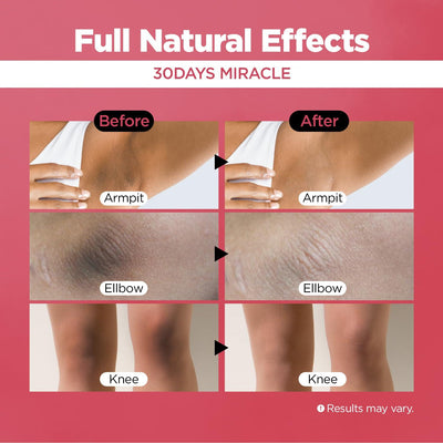 Dark Spot Corrector Cream - 50ml