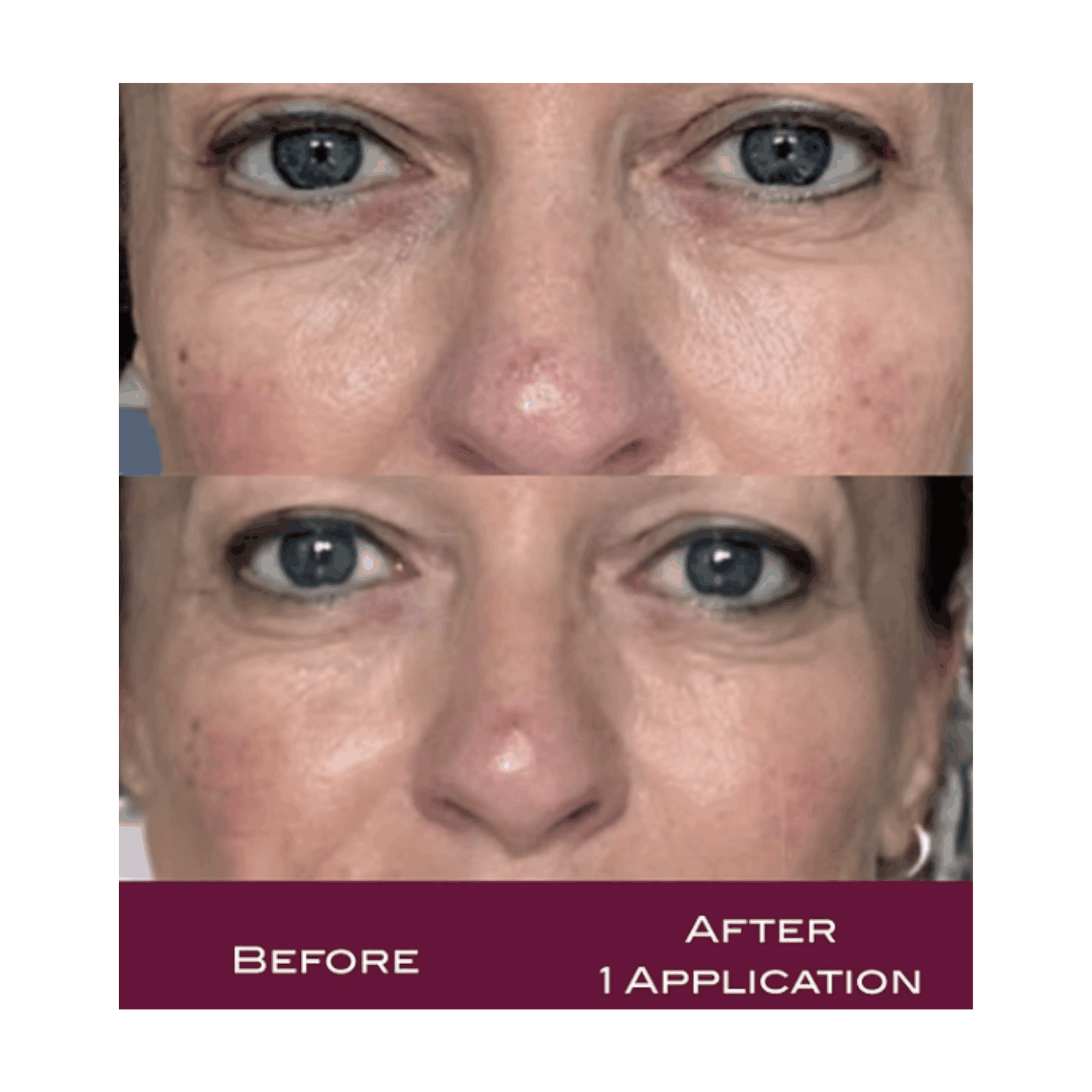 BDR - Rosa Calm - Capillary Relief Ampoule