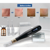 CODE-X Microneedling Pen - Optimized for Precision, Performance & Safety