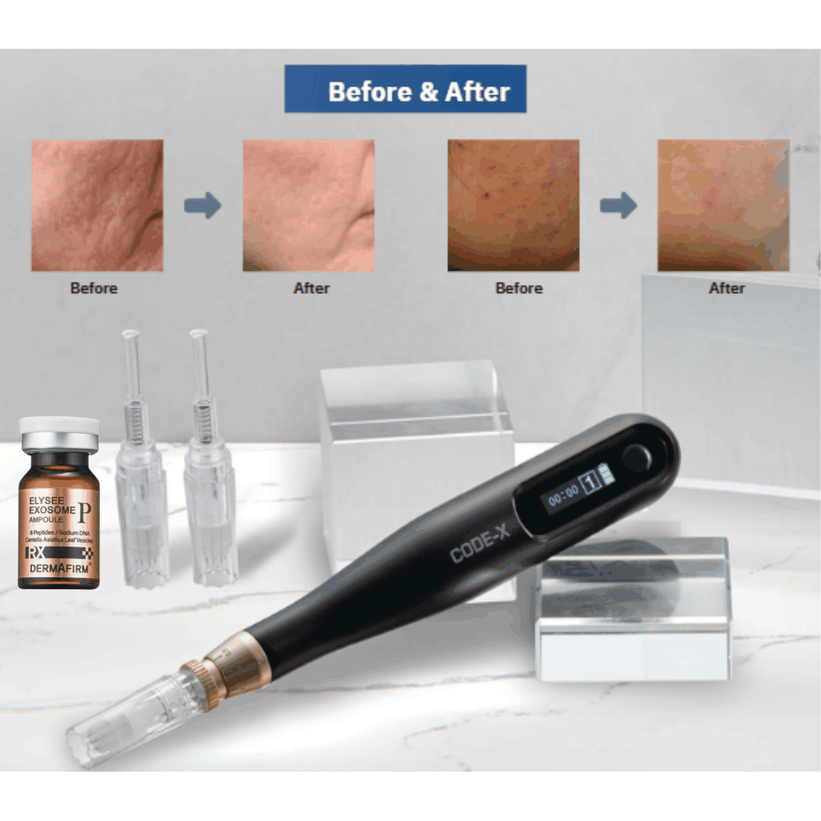 CODE-X Microneedling Pen - Optimized for Precision, Performance CODE-X Microneedling Pen - Optimized for Precision, Performance