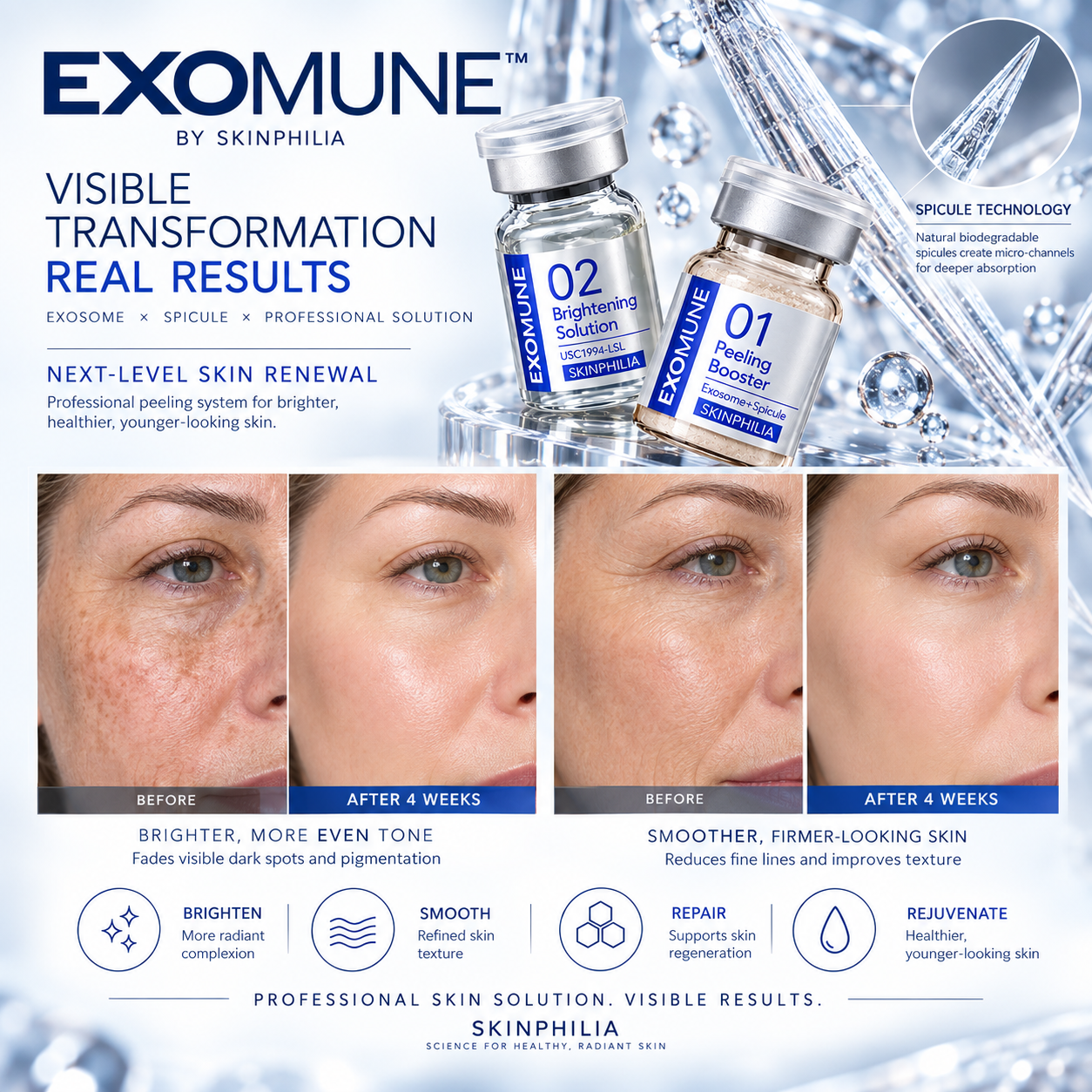 Exosome Spicule Renewal Peel (4 x 1g Vials + 4 x 5ml Vials)