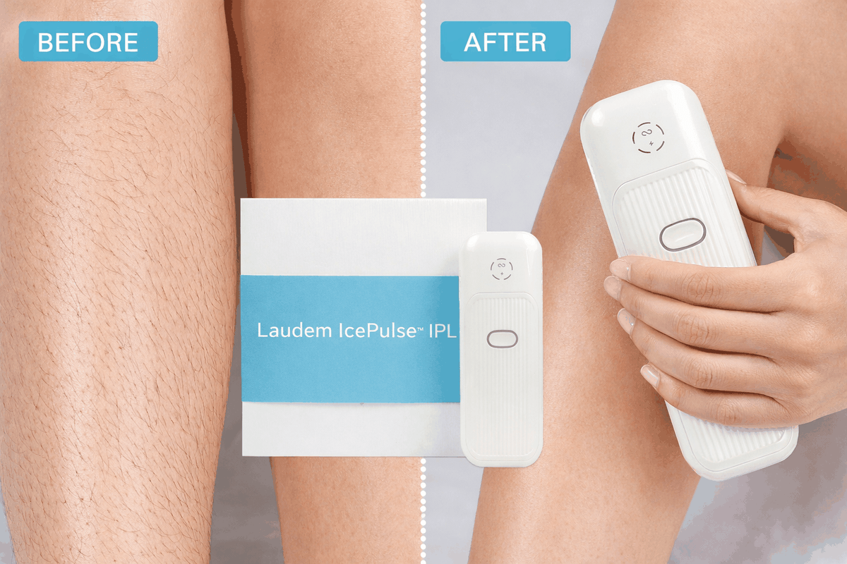 Laudem LumiPulse™ IPL (FDA 510K Cleared)