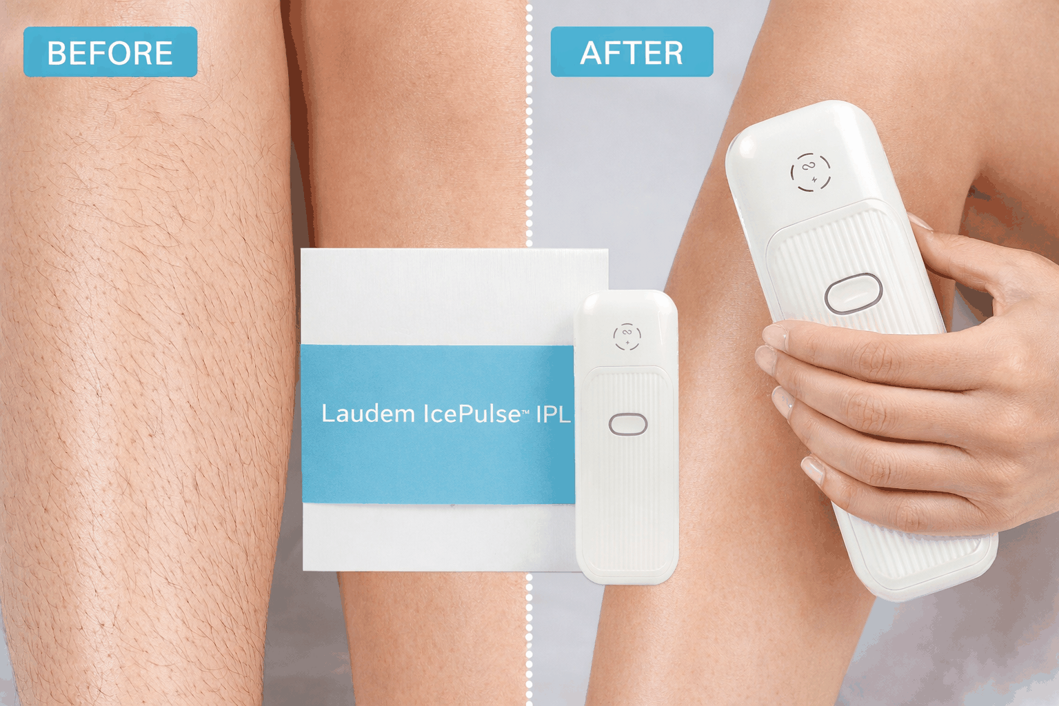 Laudem LumiPulse™ IPL (FDA 510K Cleared)