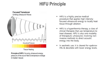 Microson Plus HIFU