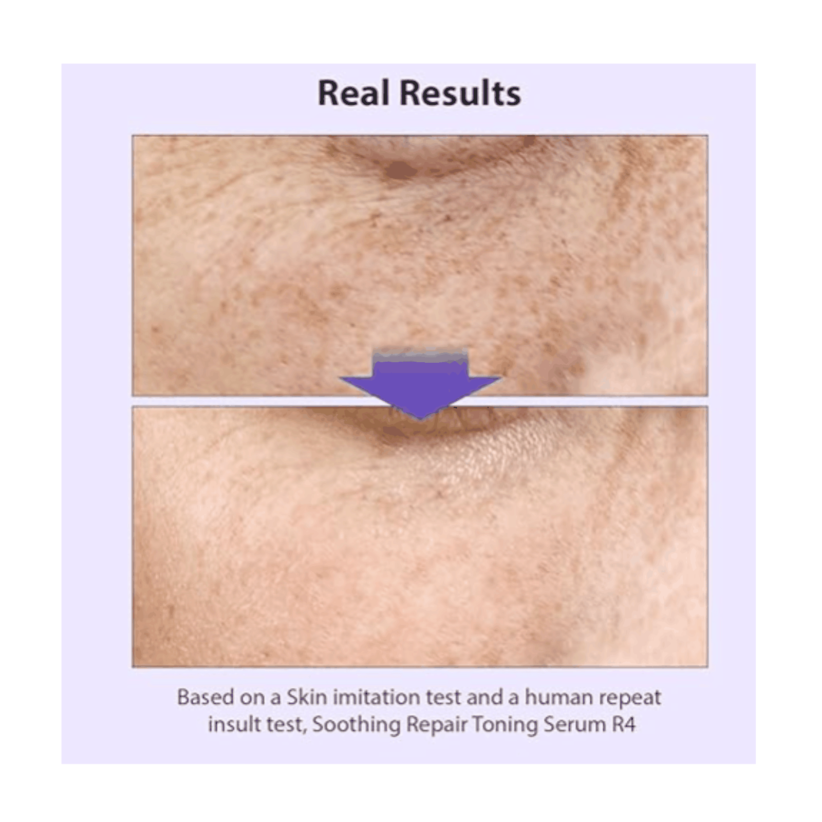 Soothing Repair Toning Serum R4 - 30ml