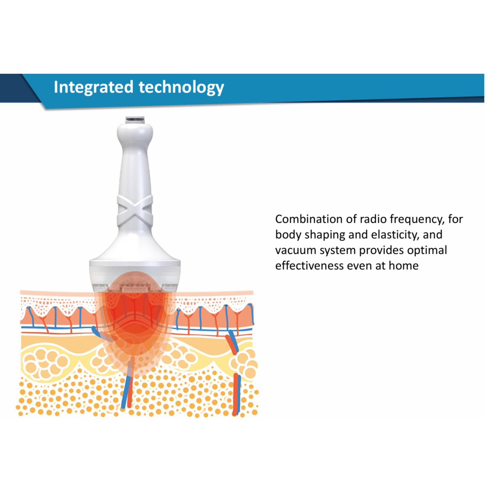 CELLTUNE ia-100RF: Professional Multipolar RF & Vacuum Body Contouring Therapy Device