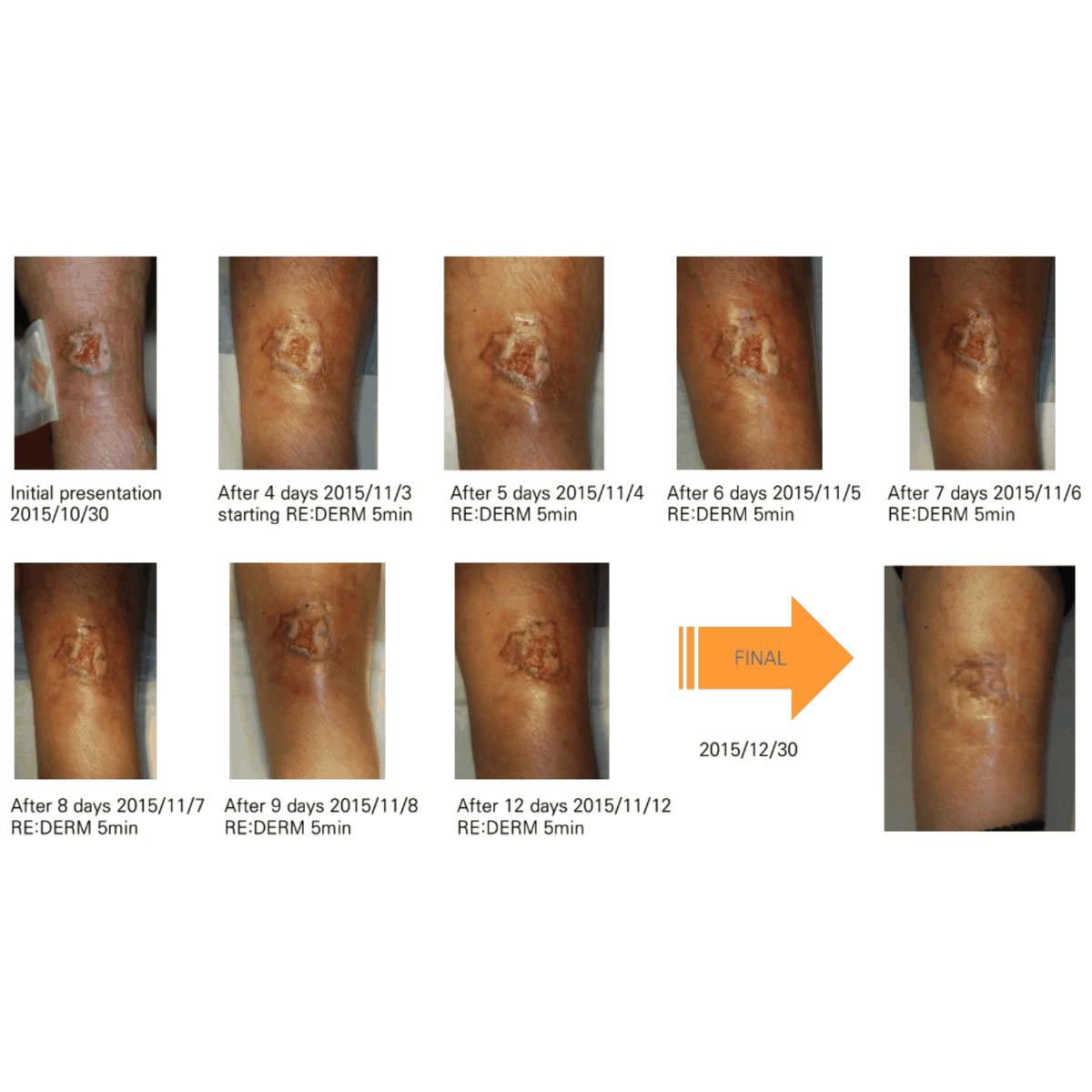 COLD PLASMA M ION TOUCH SYSTEM