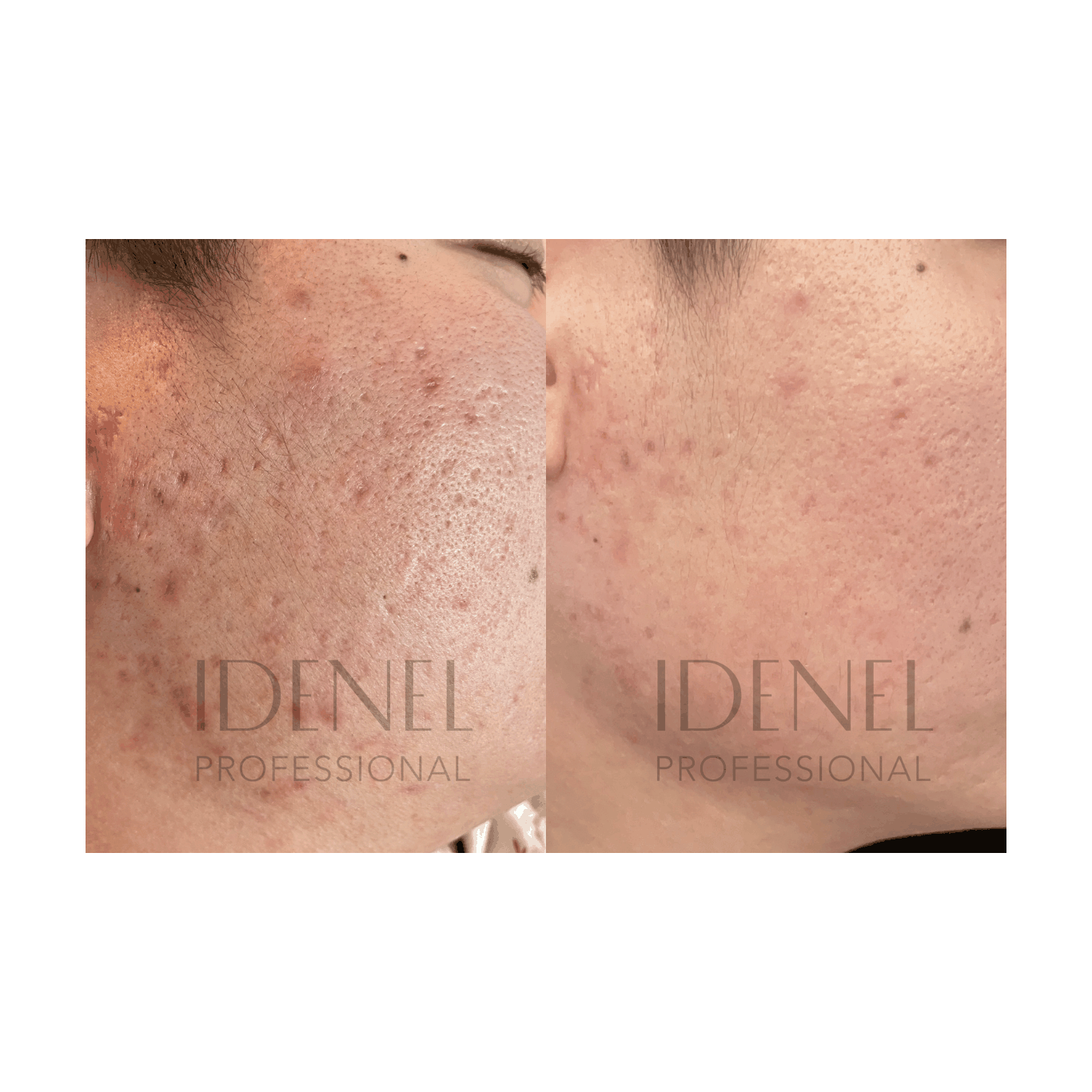 IDENEL - Spicule Revitalizing Nourishing Cream (10ml x 2)