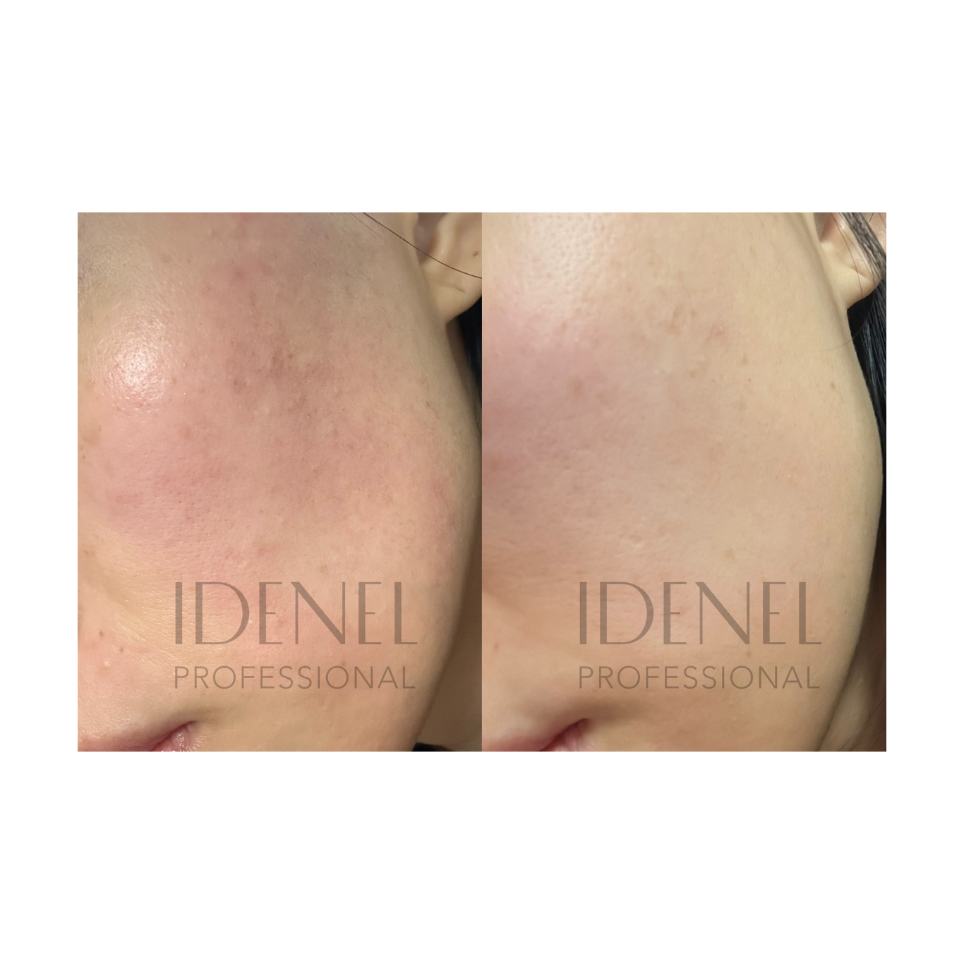 IDENEL - Revitalizing Nourishing Cream (10ml x 2)