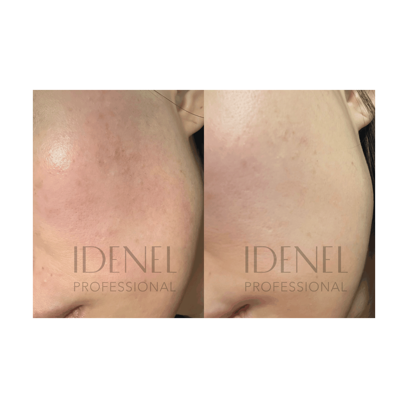 IDENEL - Spicule Revitalizing Nourishing Cream (10ml x 2)