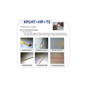 KT HMS Premier Pro Analyzer with the KPLHT Lense