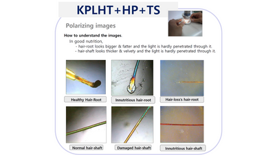 KT HMS Premier Pro Analyzer with the KPLHT Lense