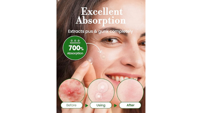 Invisible Pimple Spot Patch - 96 patches