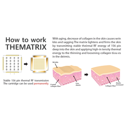 Thermatrix - Advanced Fractional RF Skin Rejuvenation System