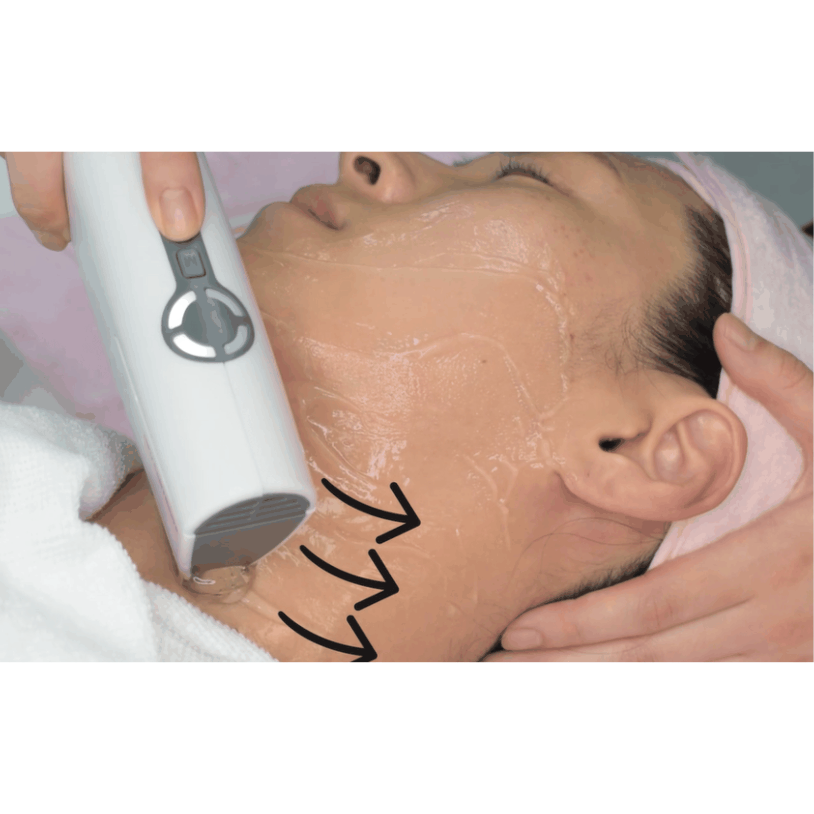 Handheld HIFU Device
