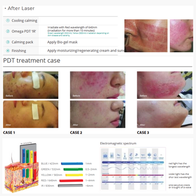 OMEGA PDT + IR Therapy System (3rd Generation)