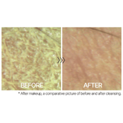 TUPS - Gel Cleanser - 250ml - Dermafirm USA