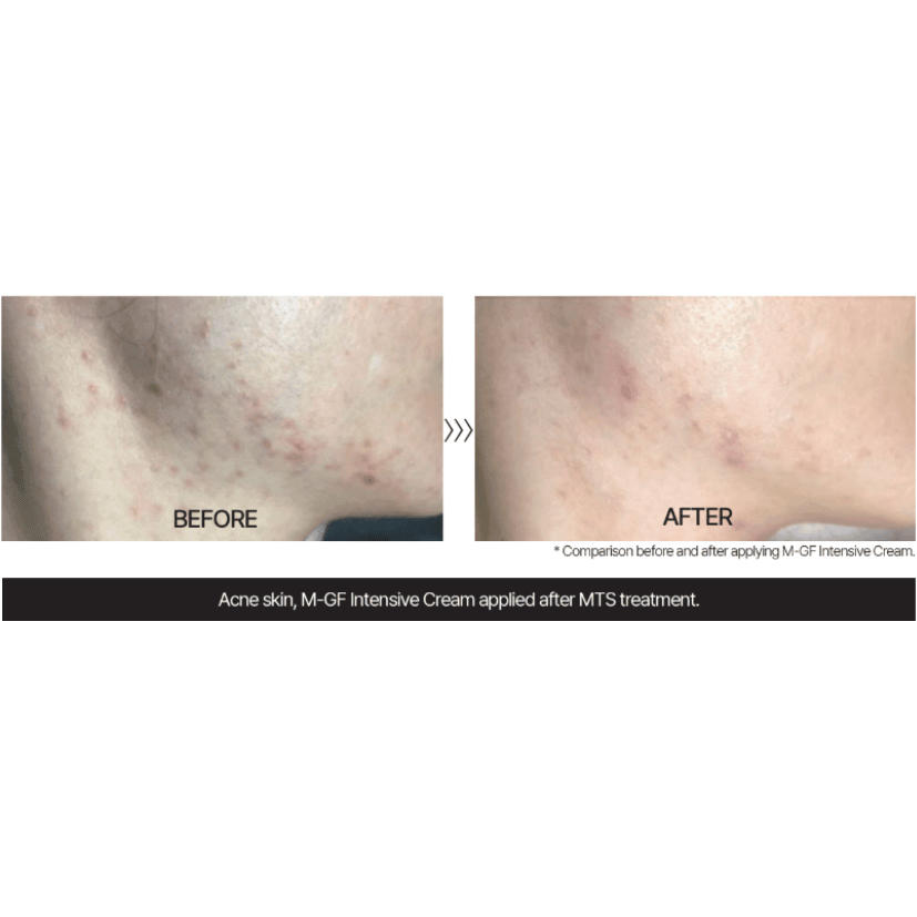 TUPS - MGF Cream - 35ml - Dermafirm USA