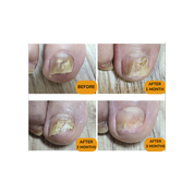 Pedi Saver - 15ml