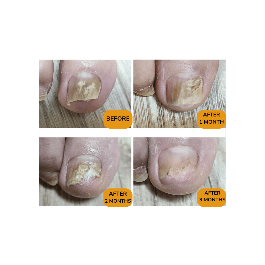 Pedi Saver - 15ml