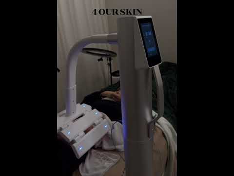 COLD PLASMA M ION TOUCH SYSTEM