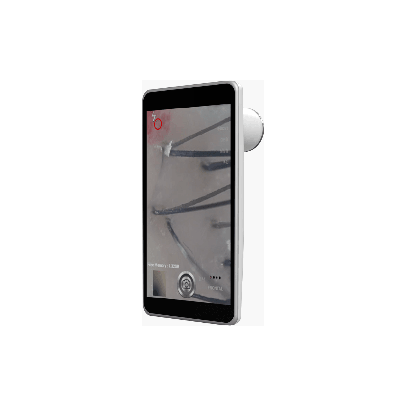 A.Tracer X - Scalp and Skin Detector & Analyzer - Dermafirm USA