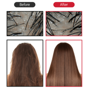 BallVic - Hair Pack Conditioner - 200g - Dermafirm USA