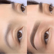 Staccato - Scalp Micropigmentation (SMP) Machine - Dermafirm USA