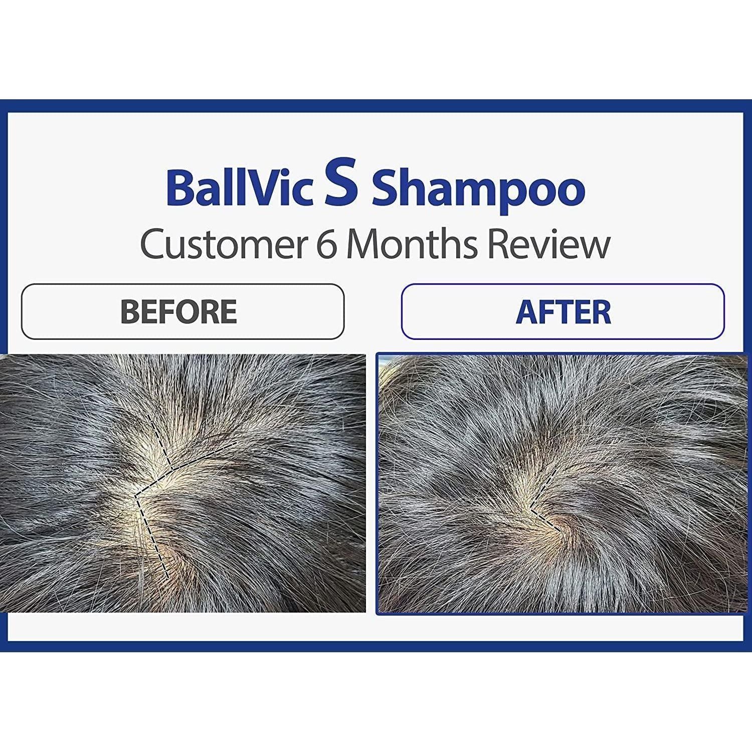 BallVic "S" Shampoo for Men - 230g - Dermafirm USA