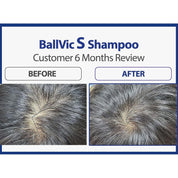 BallVic "S" Shampoo for Men - 230g - Dermafirm USA